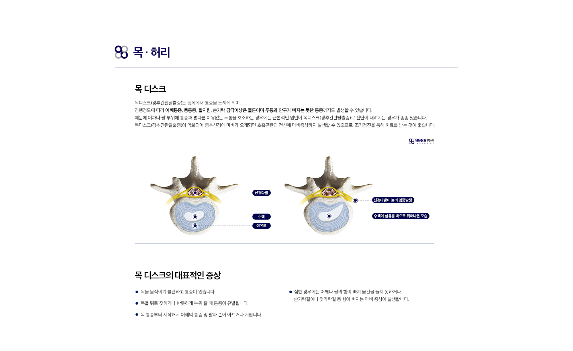 목 디스크