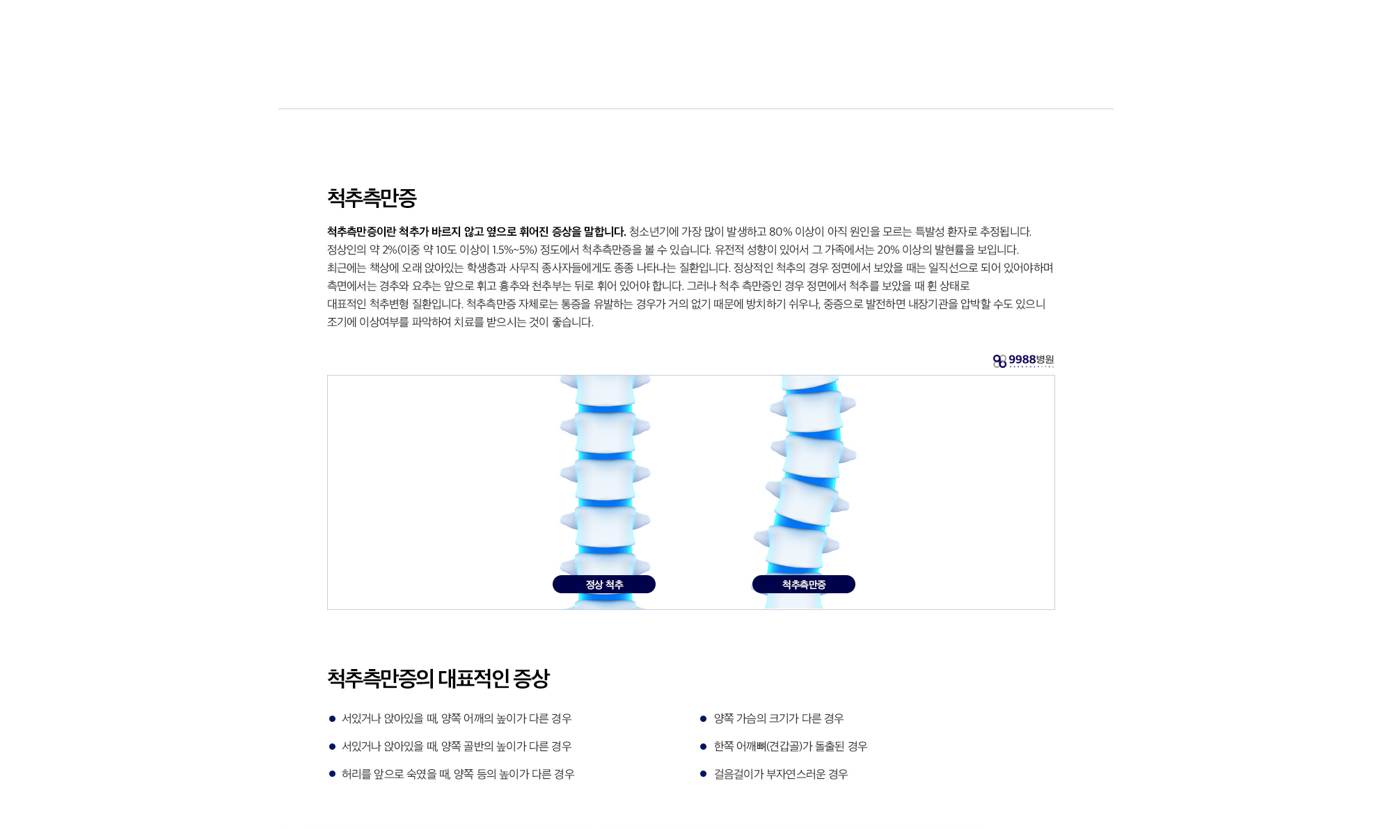 척추측만증