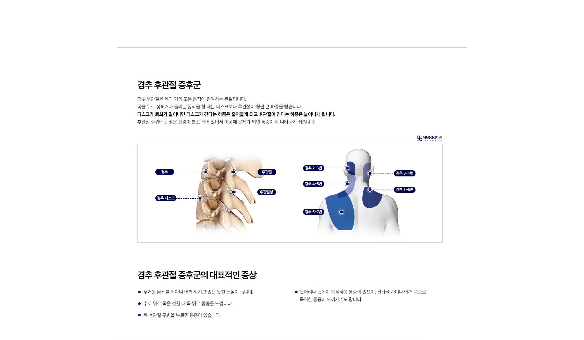경추 후관절 증후군