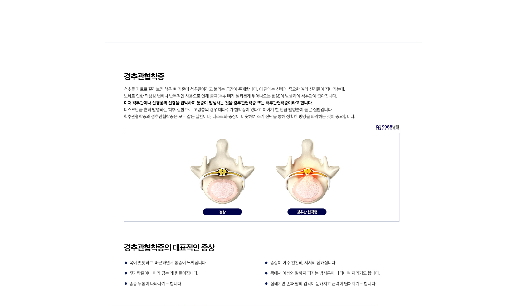 경추관협착증