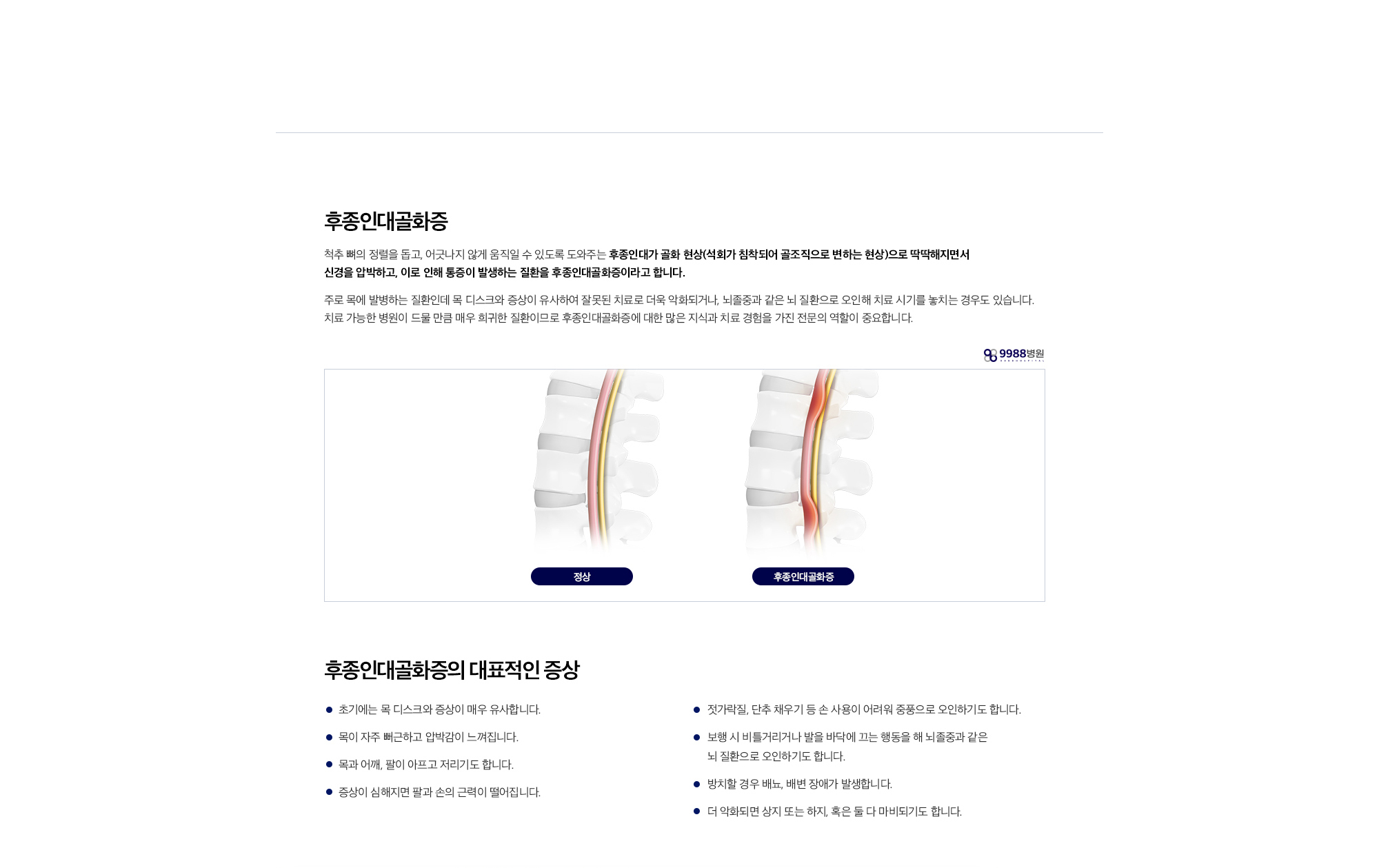 후종인대골화증