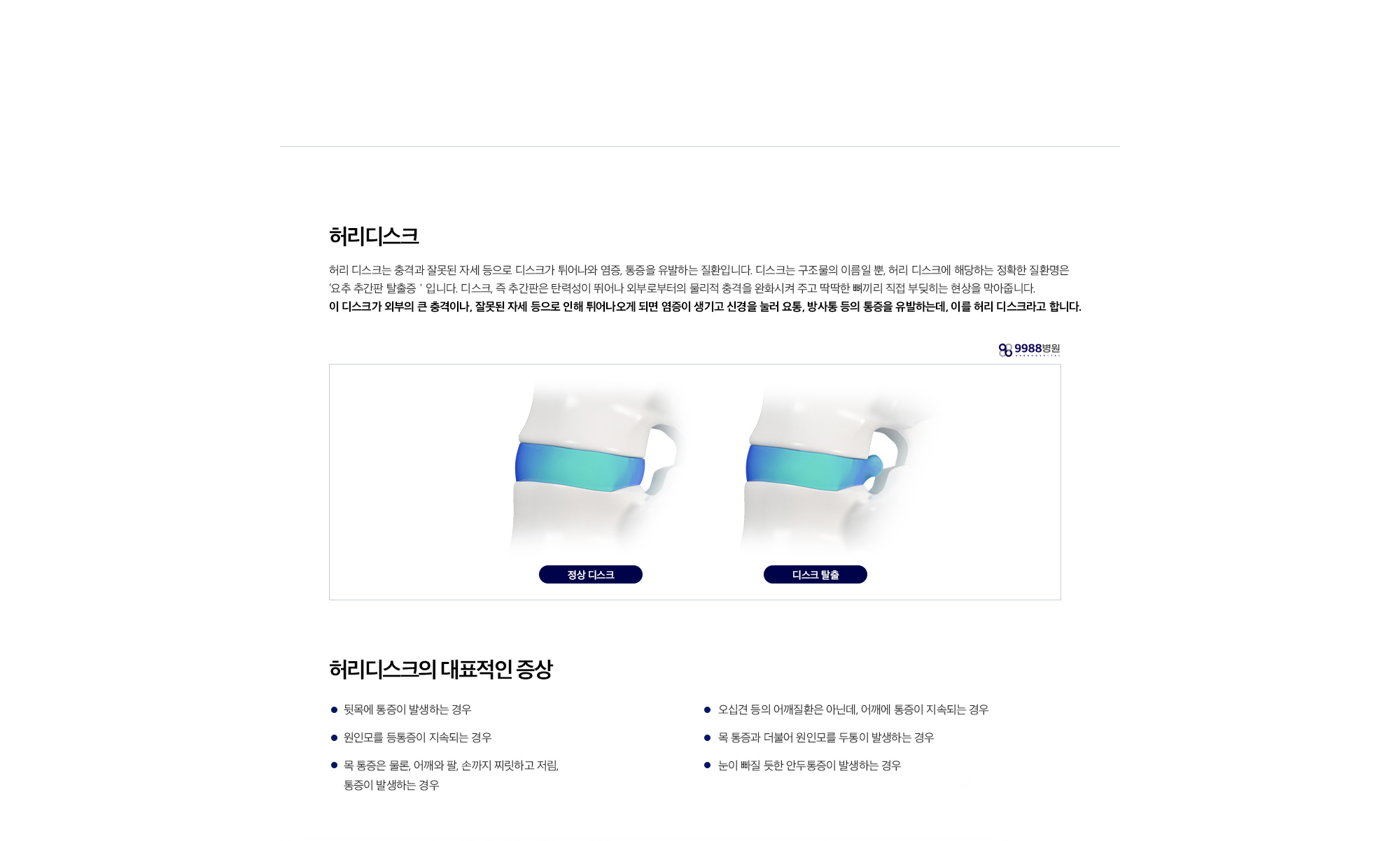 허리디스크