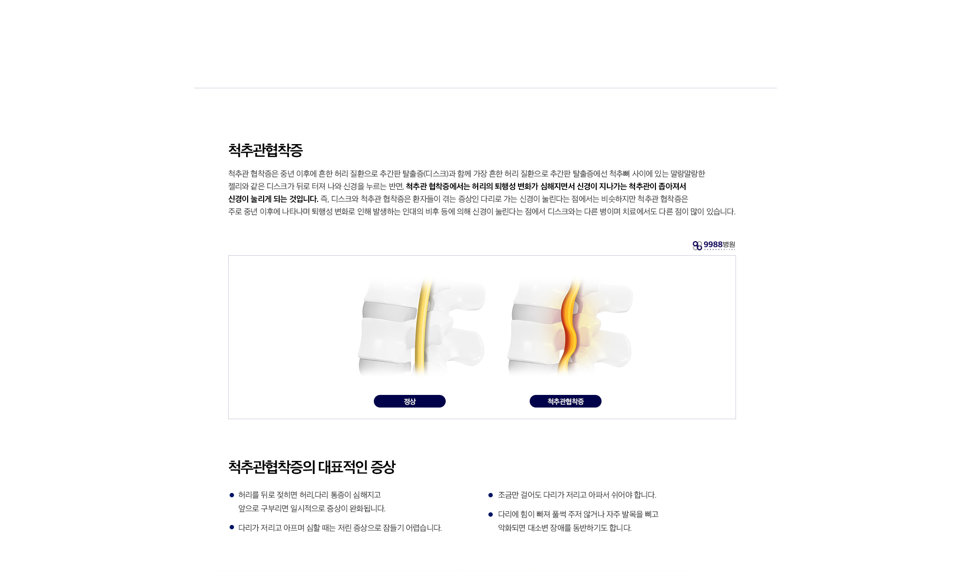 척추관협착증