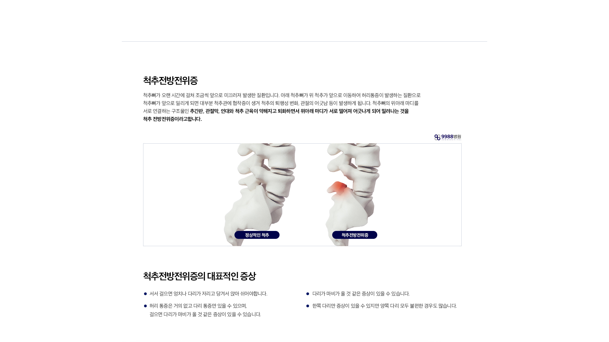 척추전방전위증