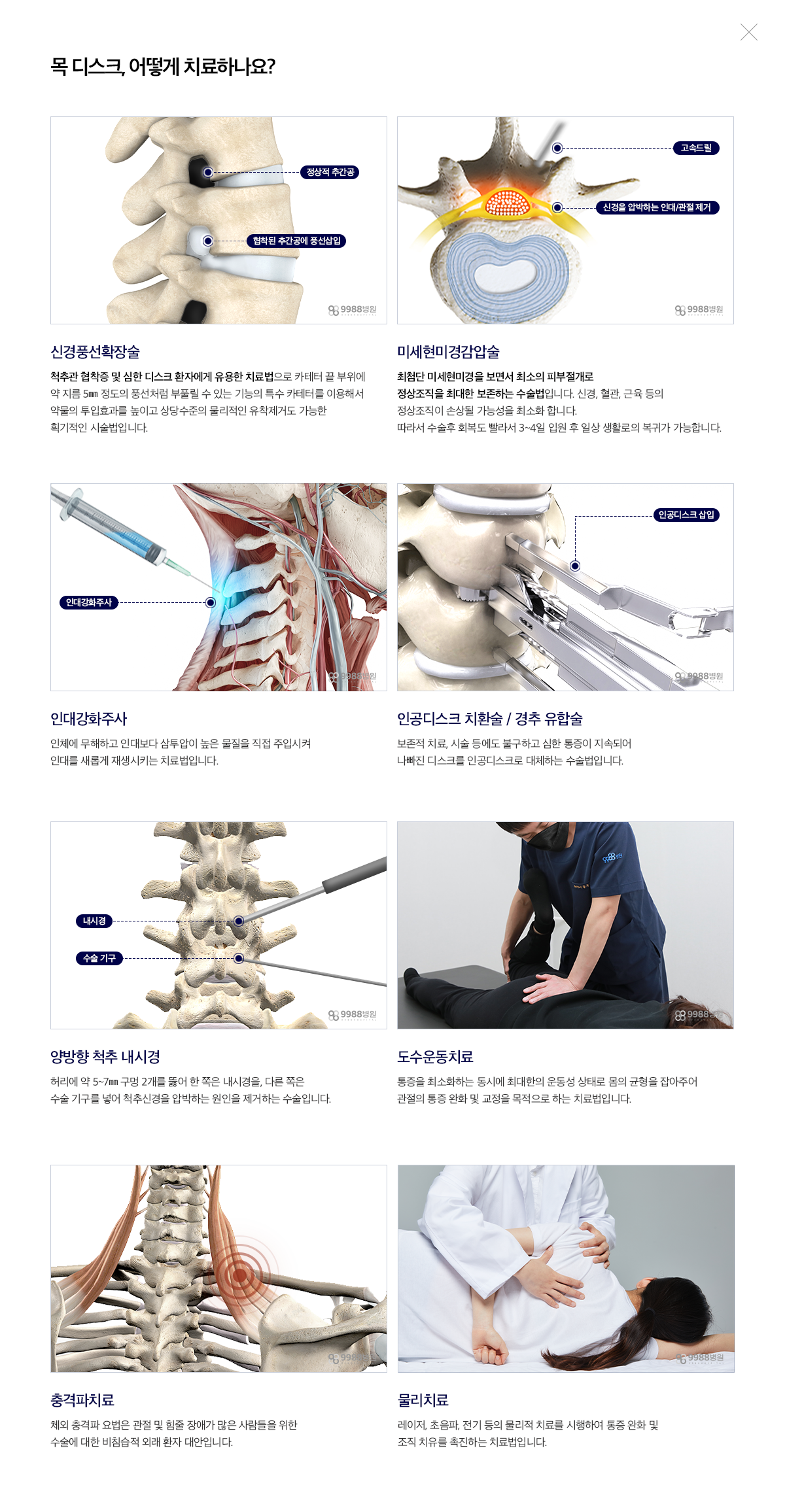 목 디스크