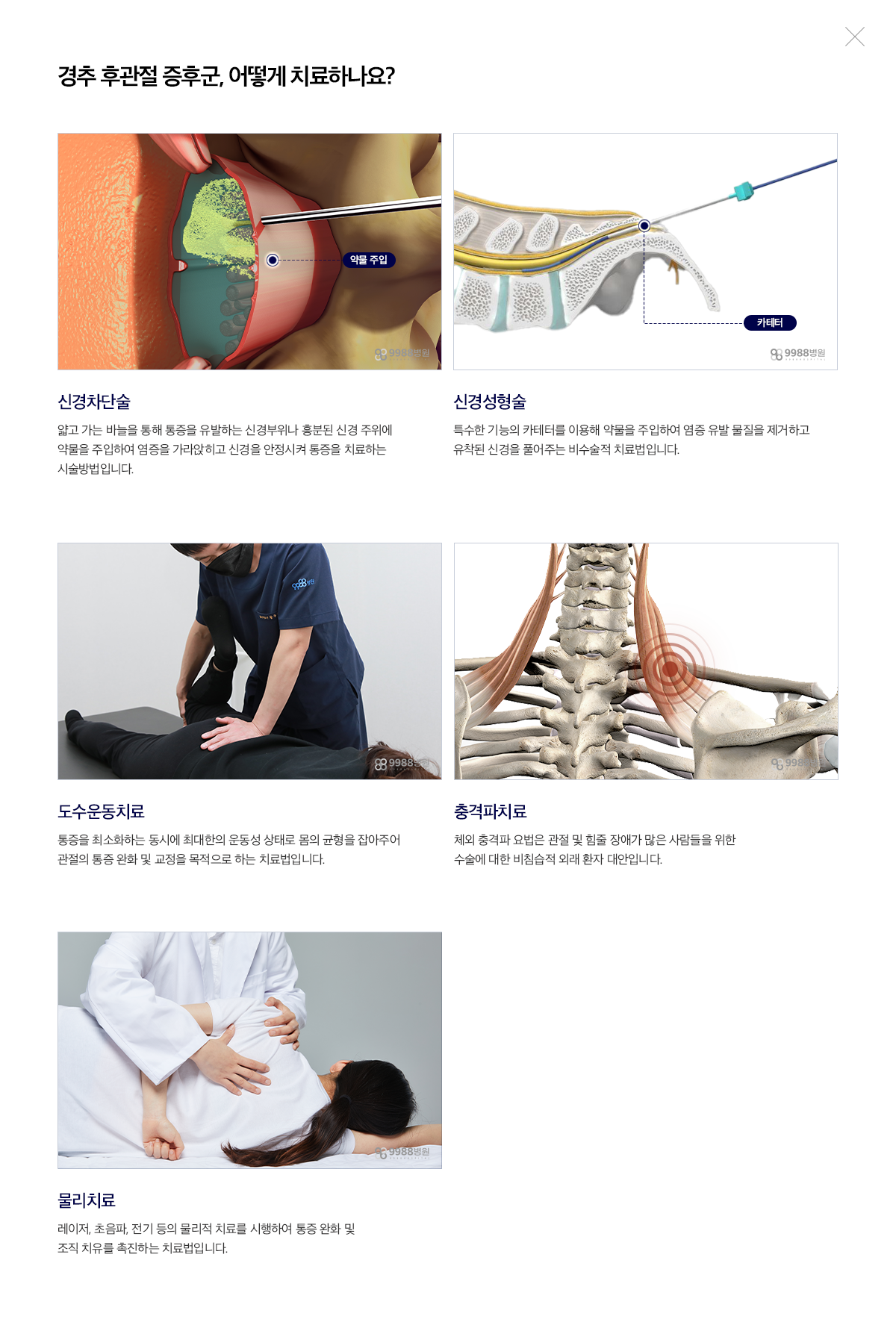 경추 후관절 증후군