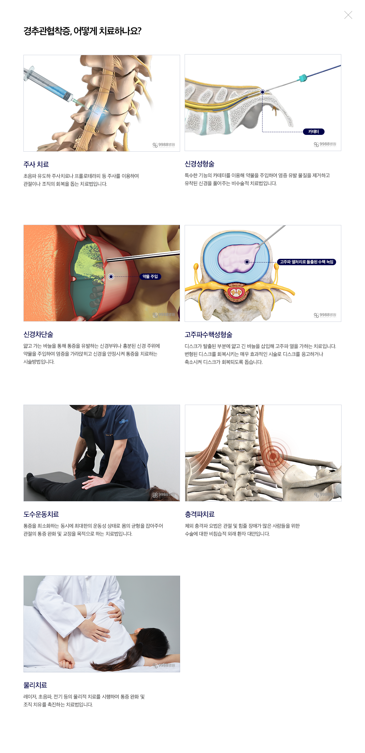 경추관협착증