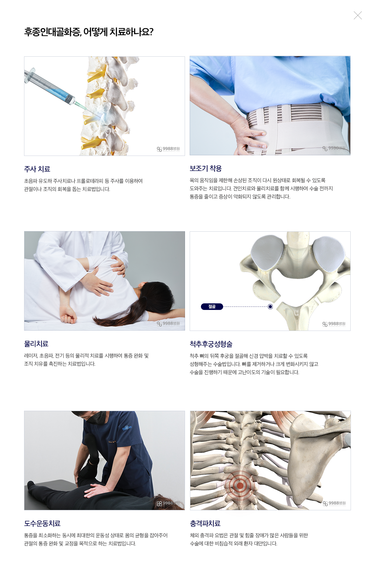 후종인대골화증