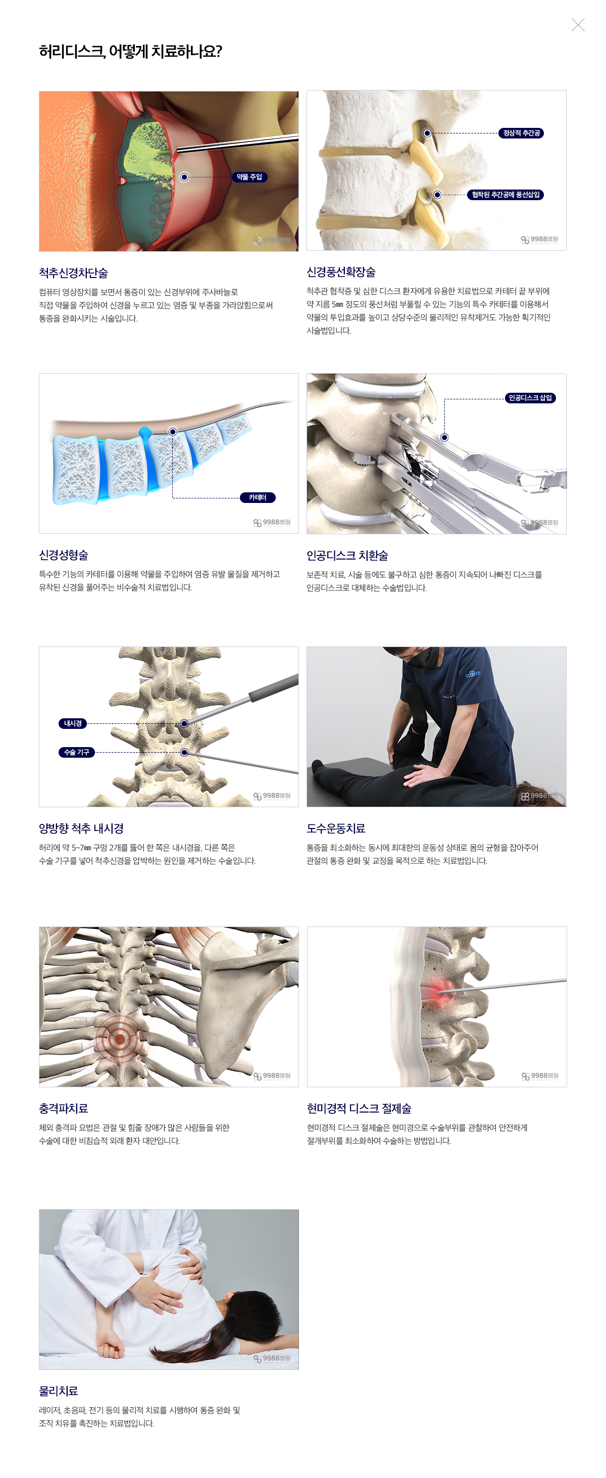 허리디스크