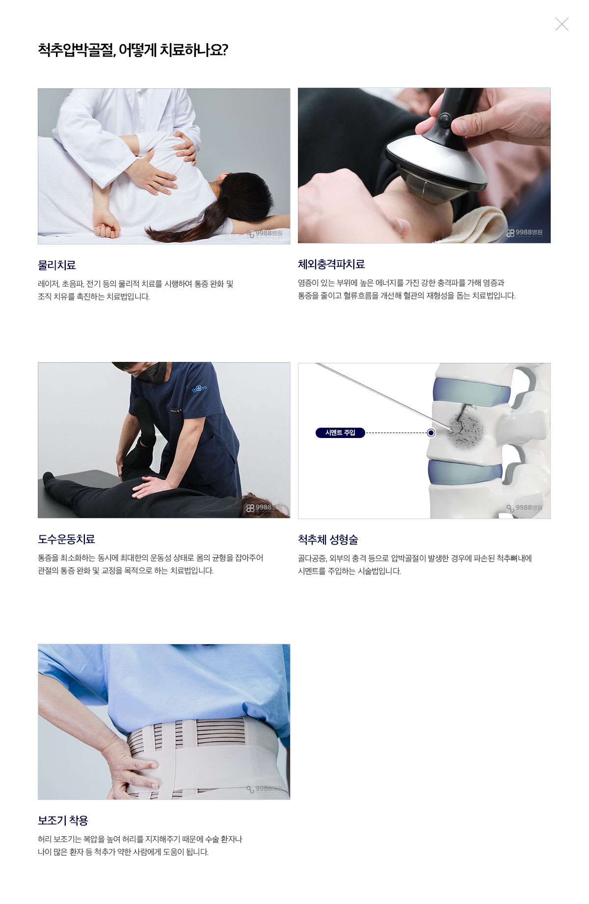 척추압박골절