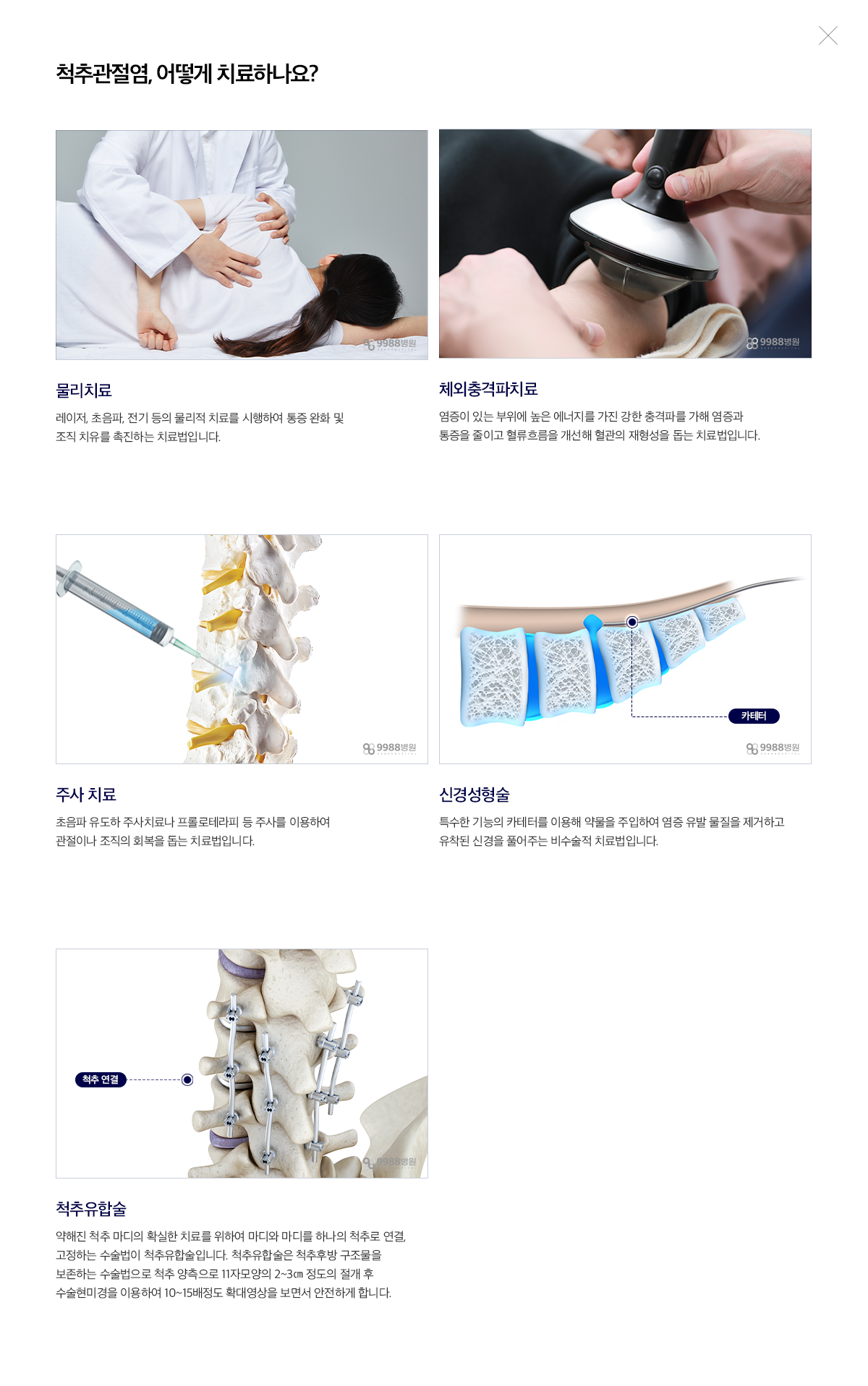 척추관절염