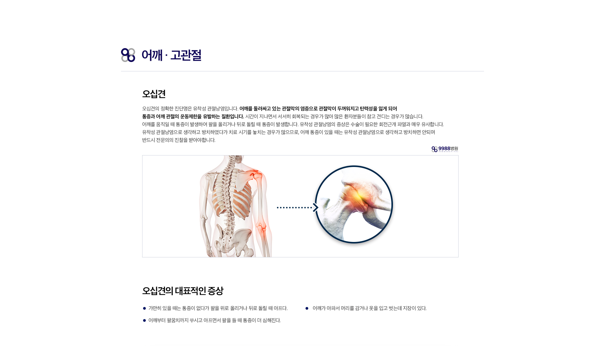 오십견