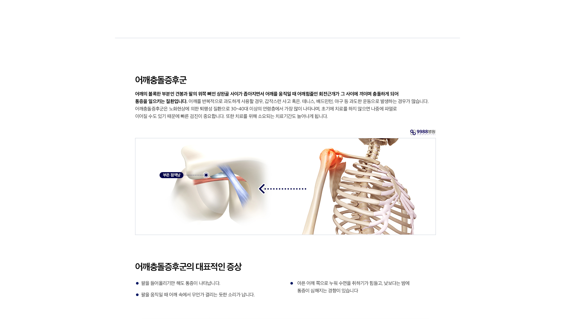 어깨충돌증후군