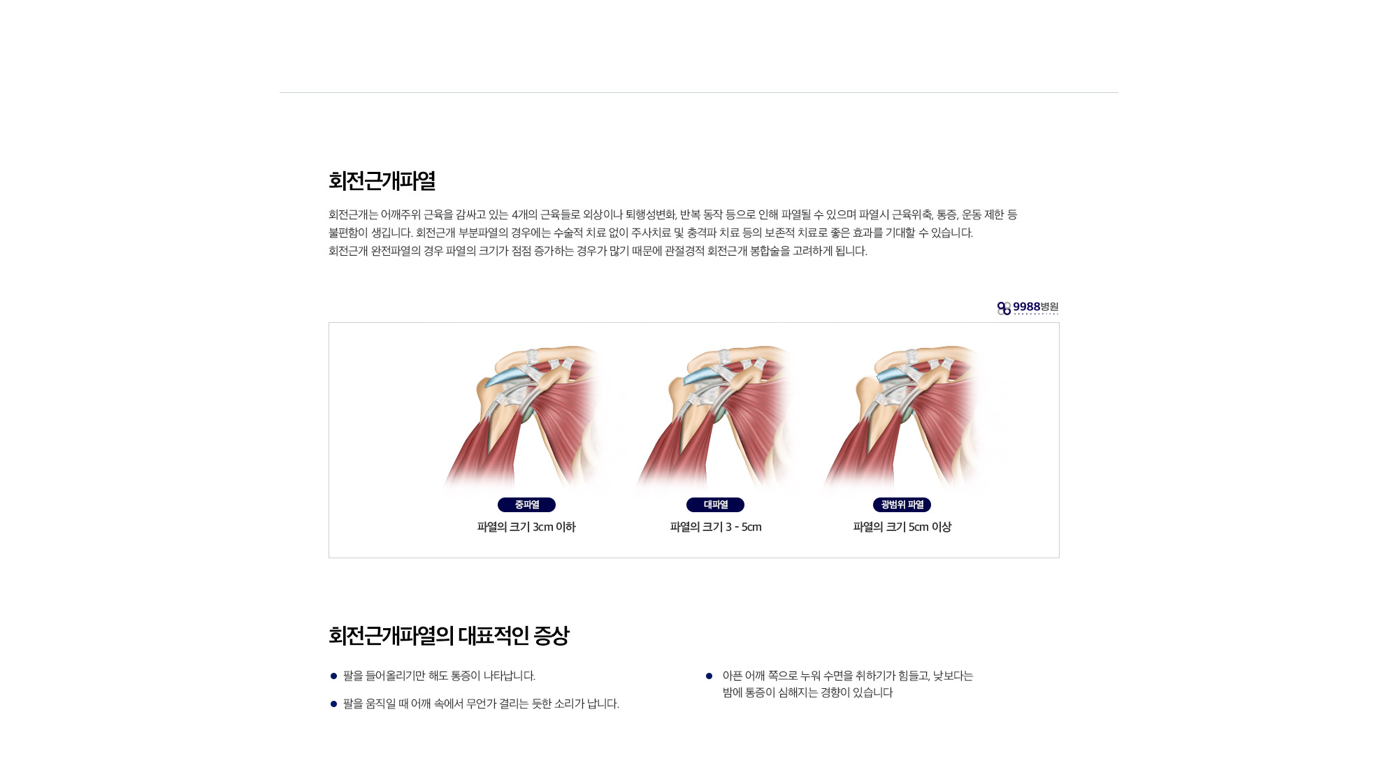 회전근개파열