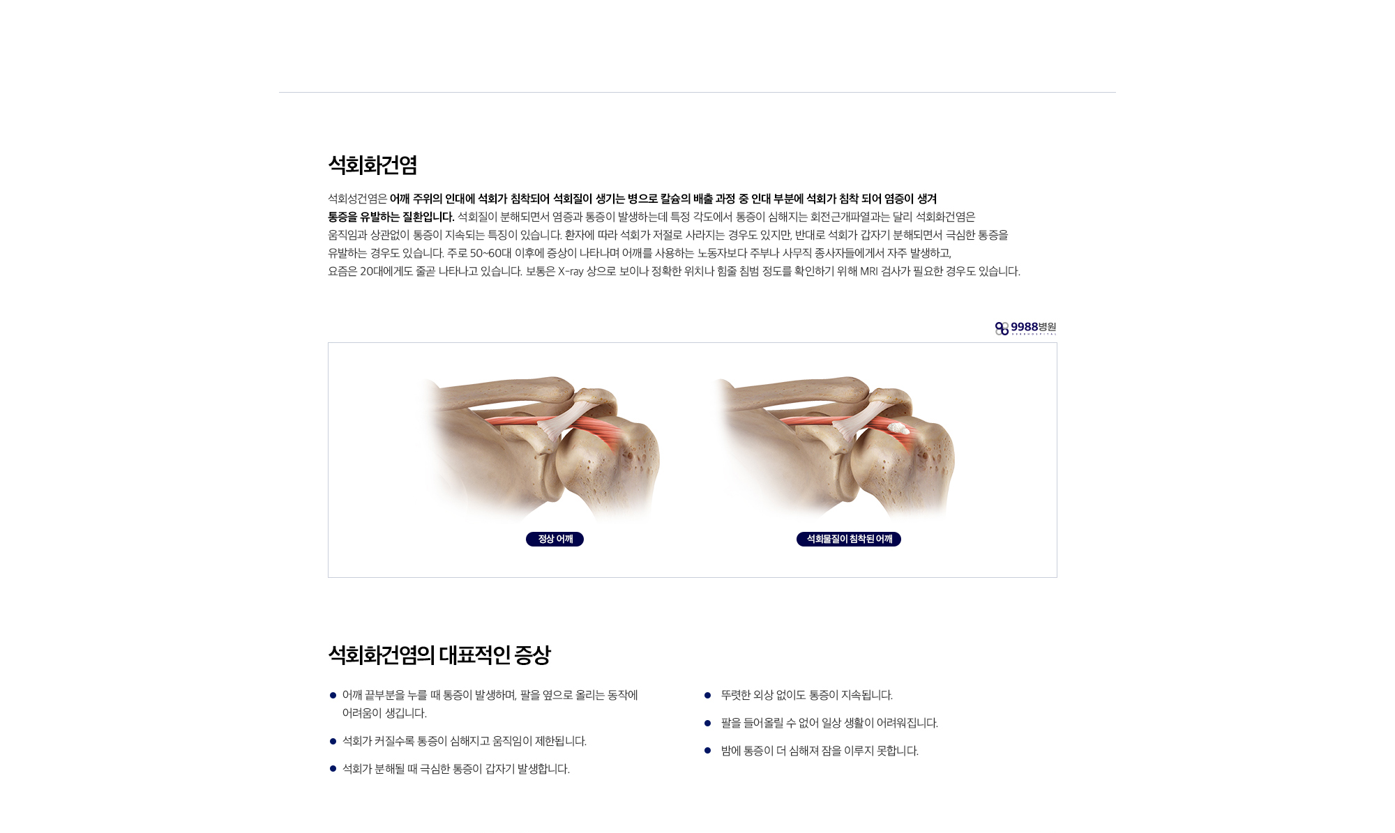 석회화건염