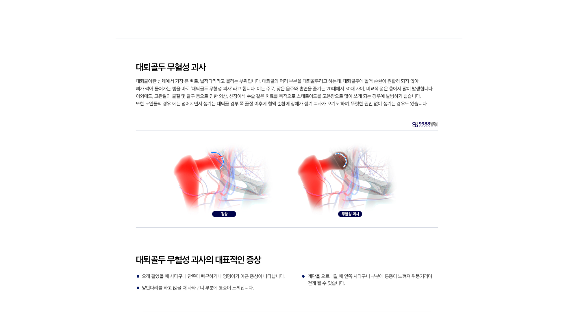 대퇴골두 무혈성괴사