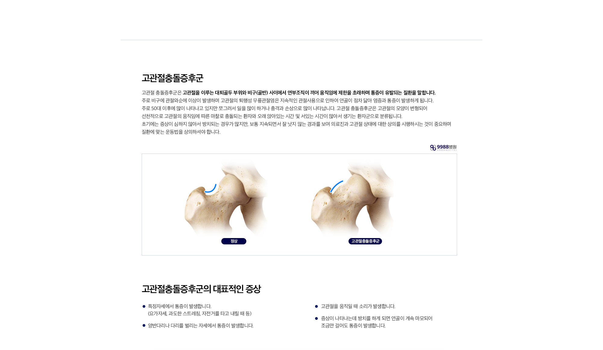 고관절충돌증후군