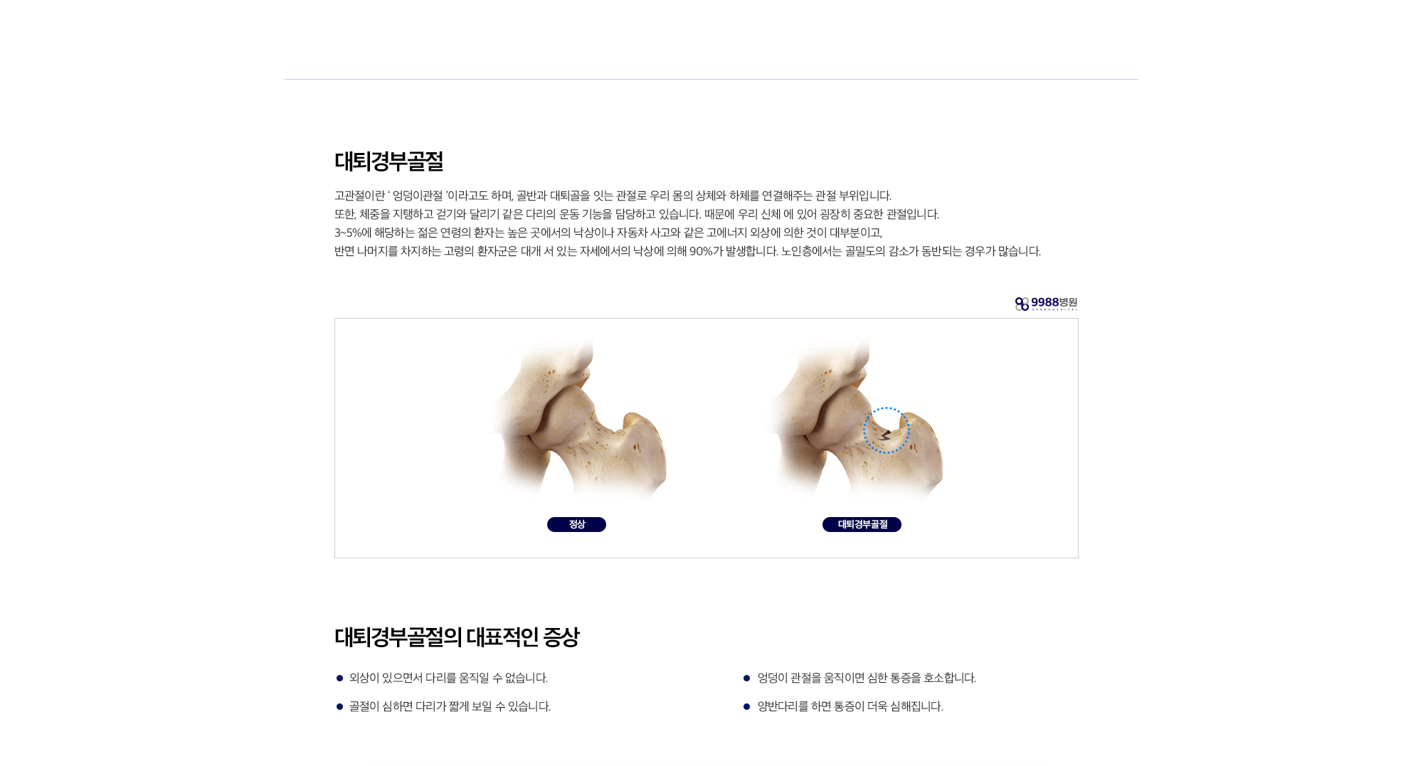 대퇴경부골절