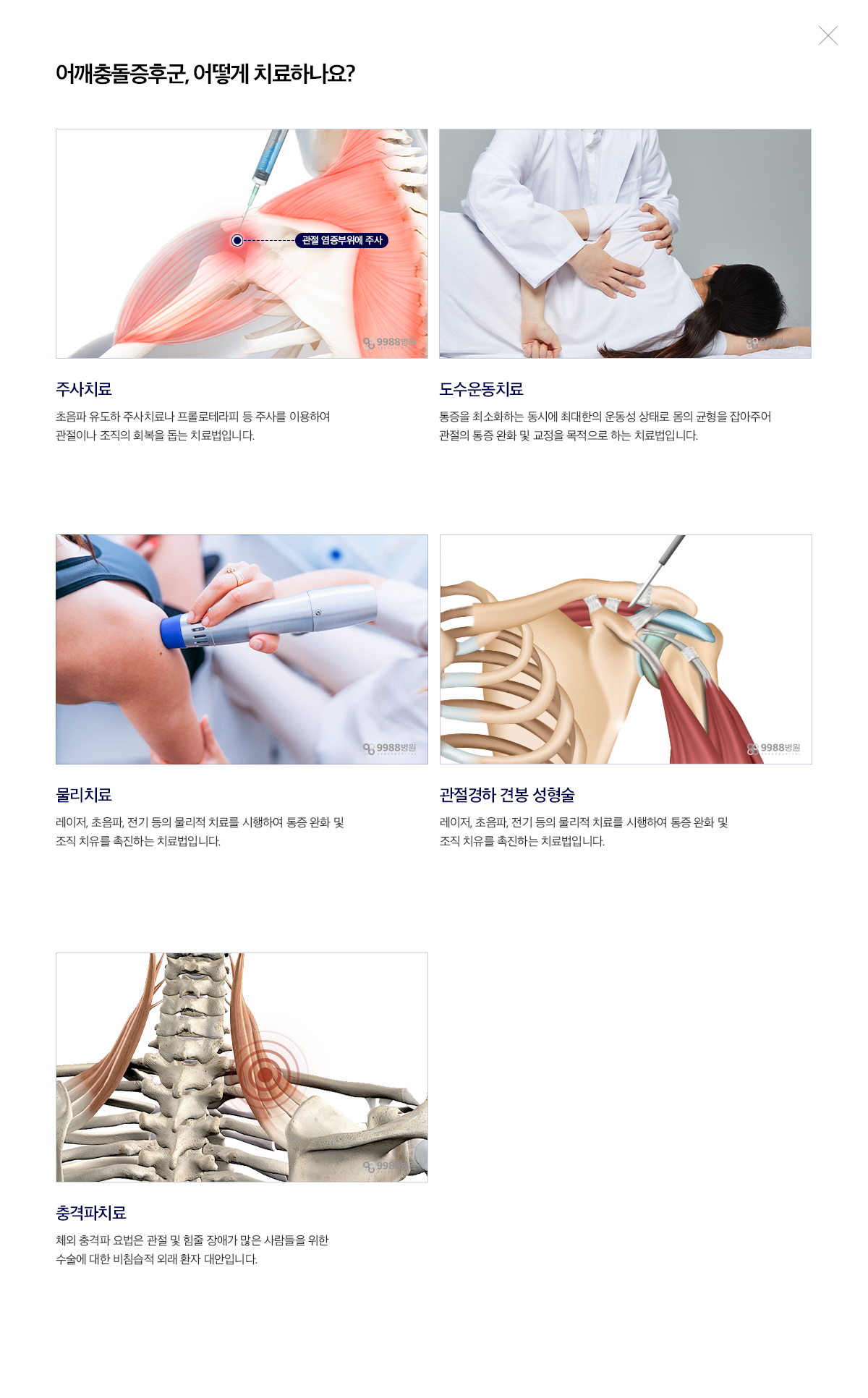 어깨충돌증후군
