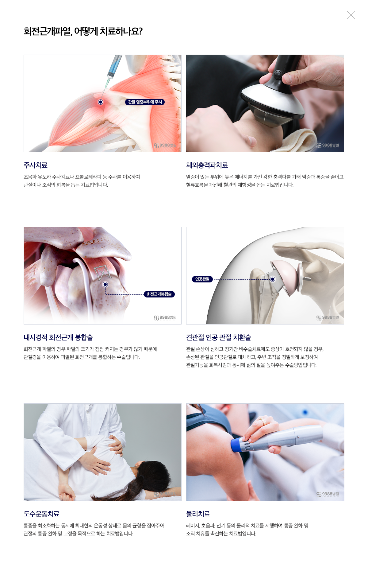 회전근개파열