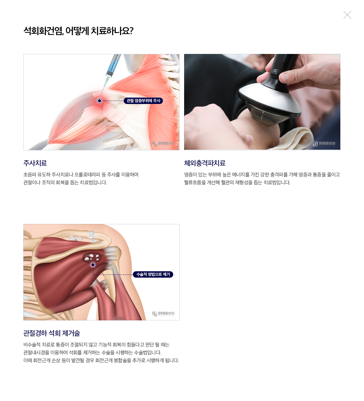 석회화건염