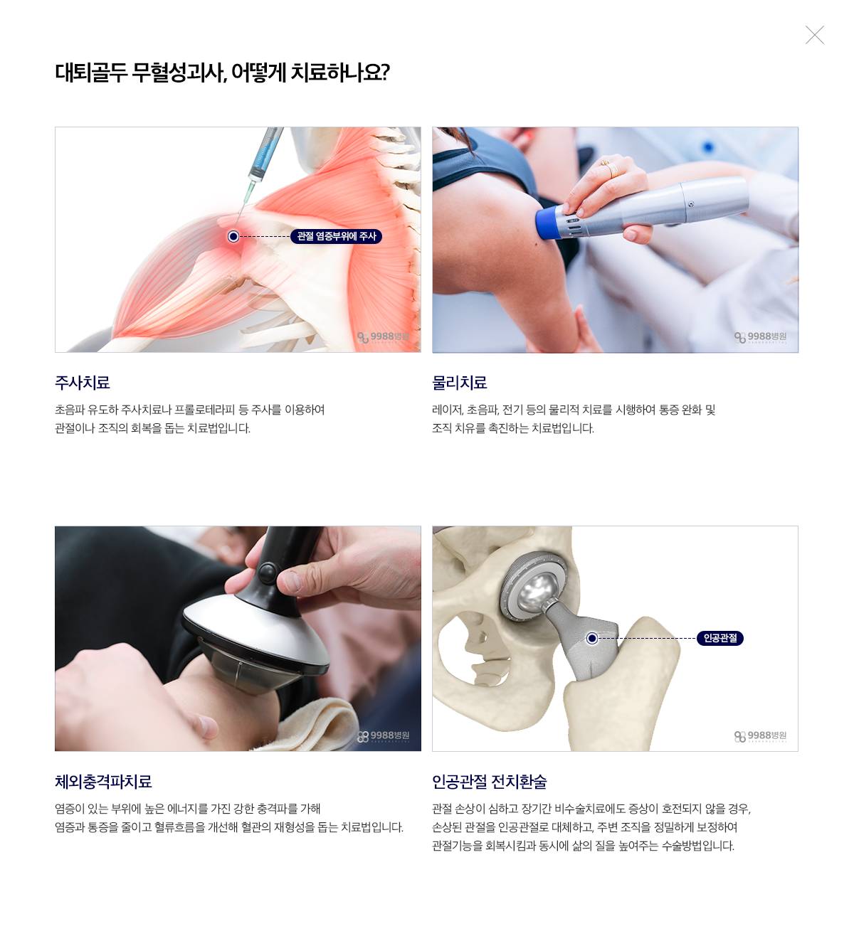대퇴골두 무혈성괴사