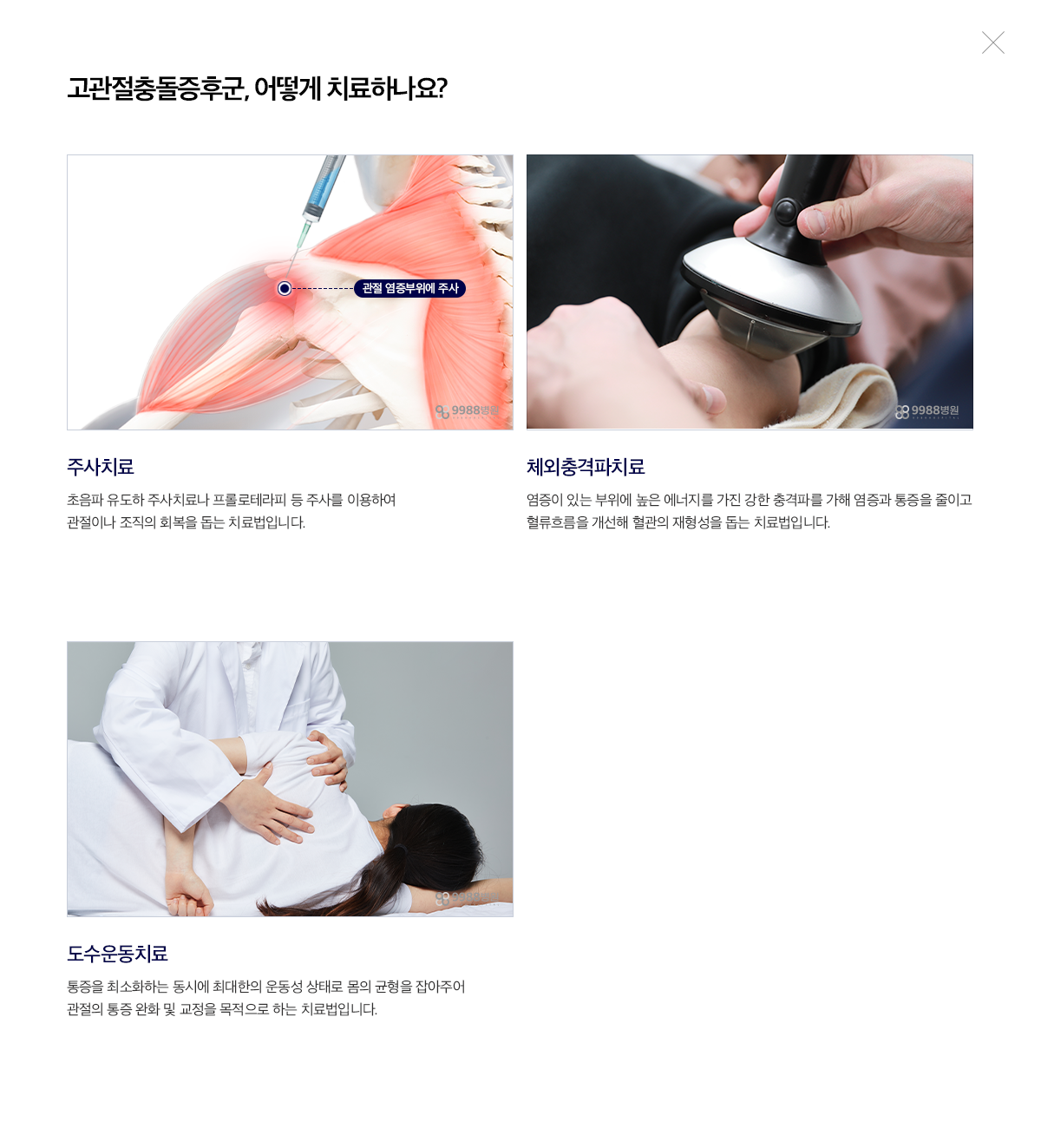 고관절충돌증후군