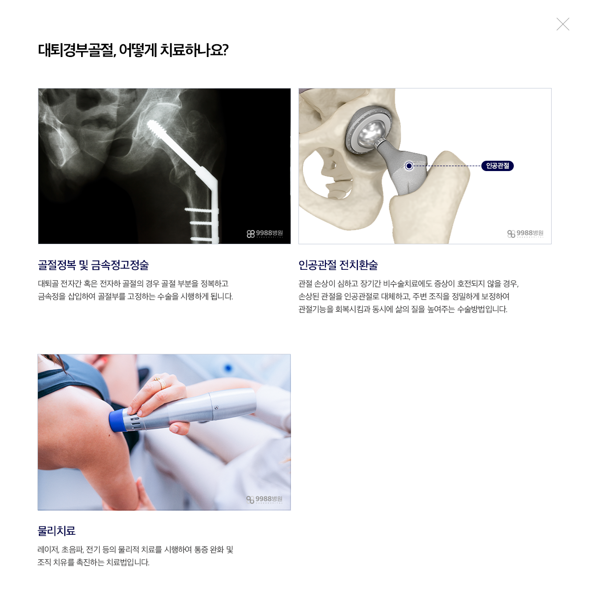 대퇴경부골절