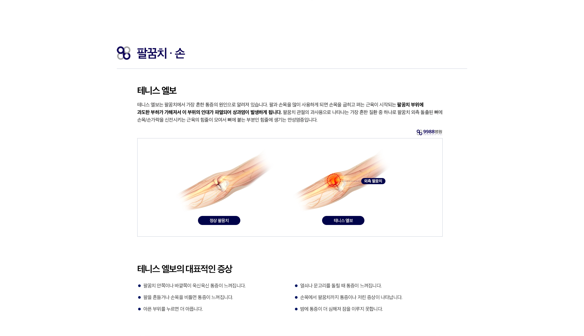 테니스 엘보