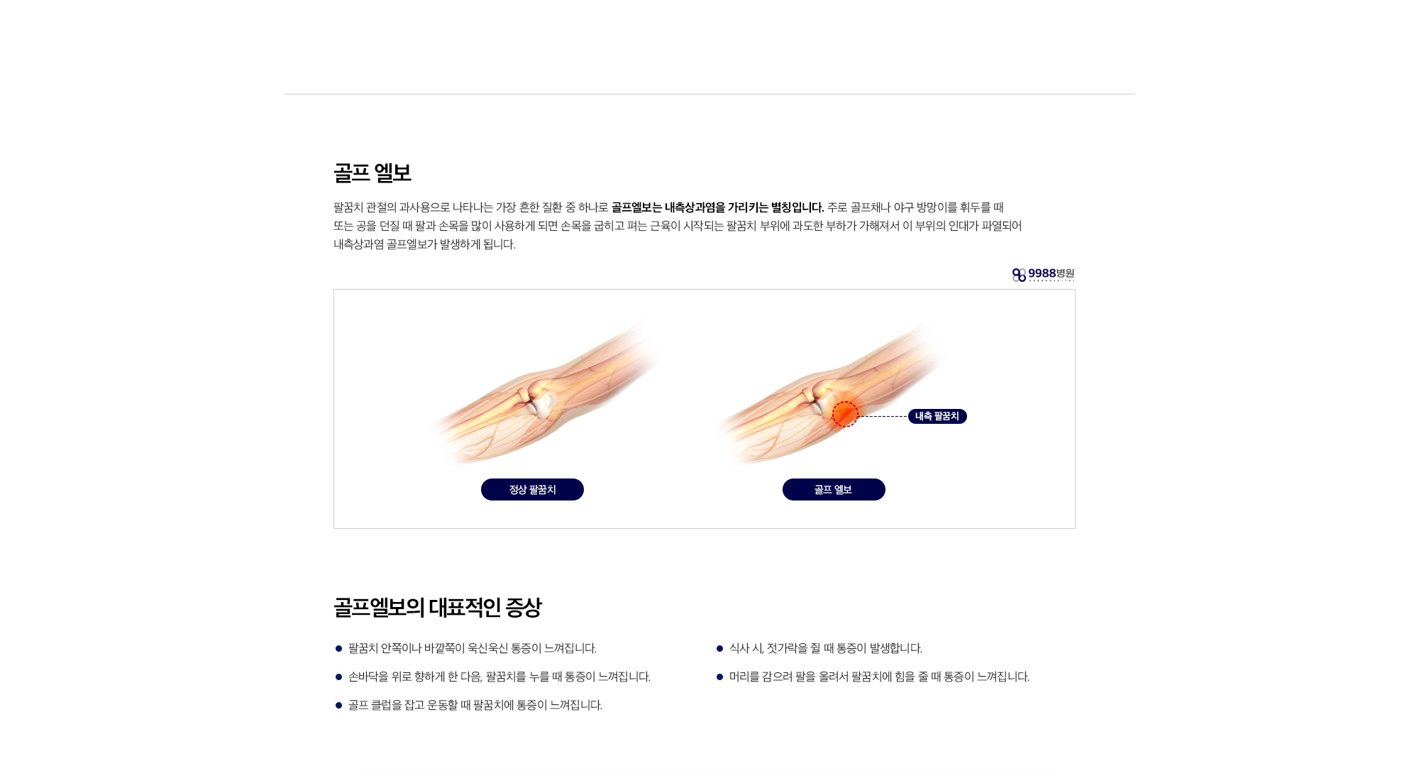 골프 엘보