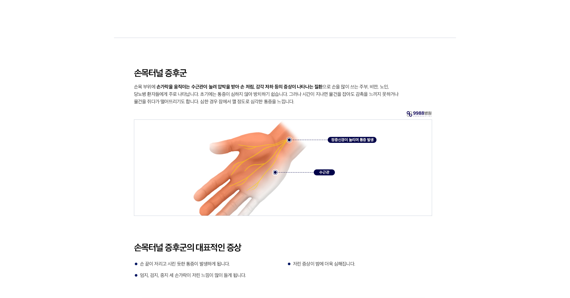 손목터널증후군