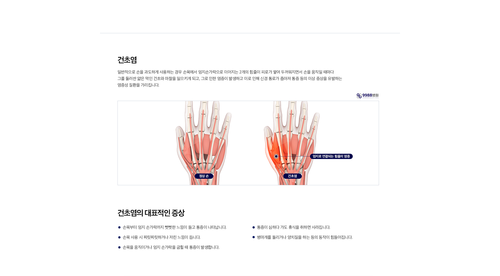 건초염