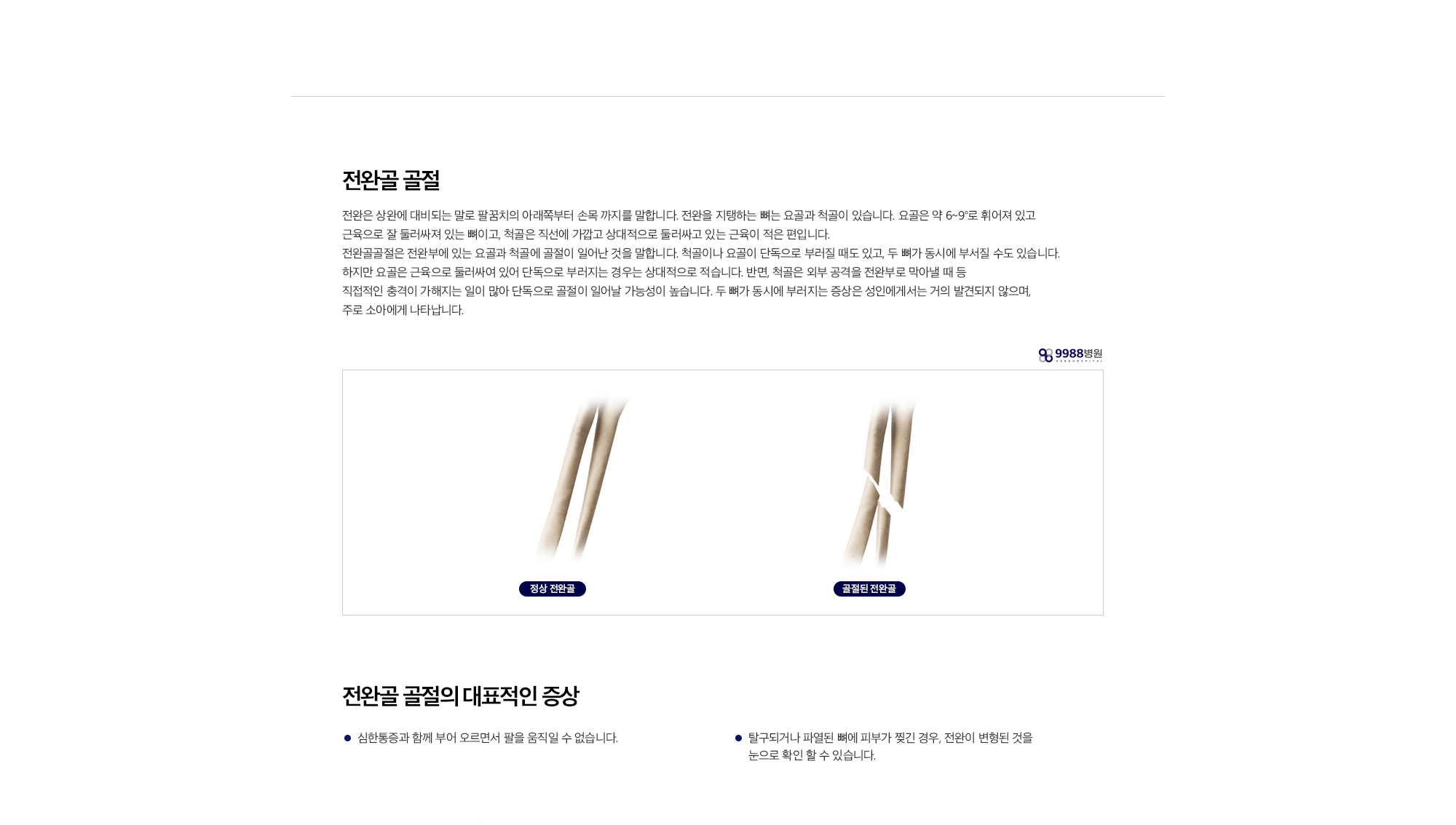 전완골 골절