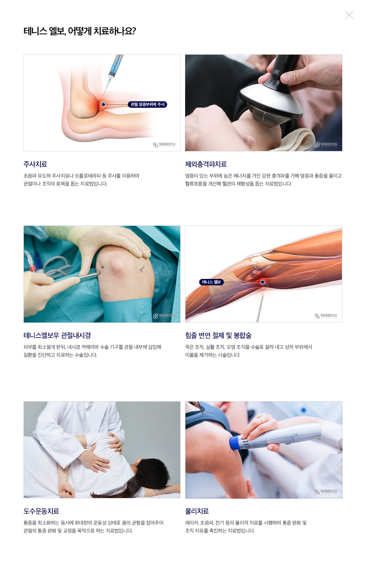 테니스 엘보