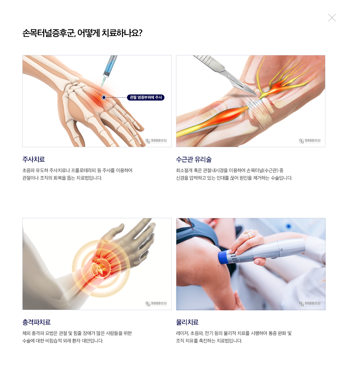 손목터널증후군
