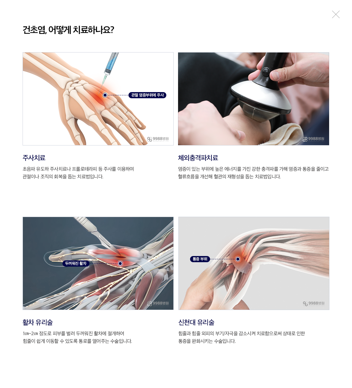 건초염