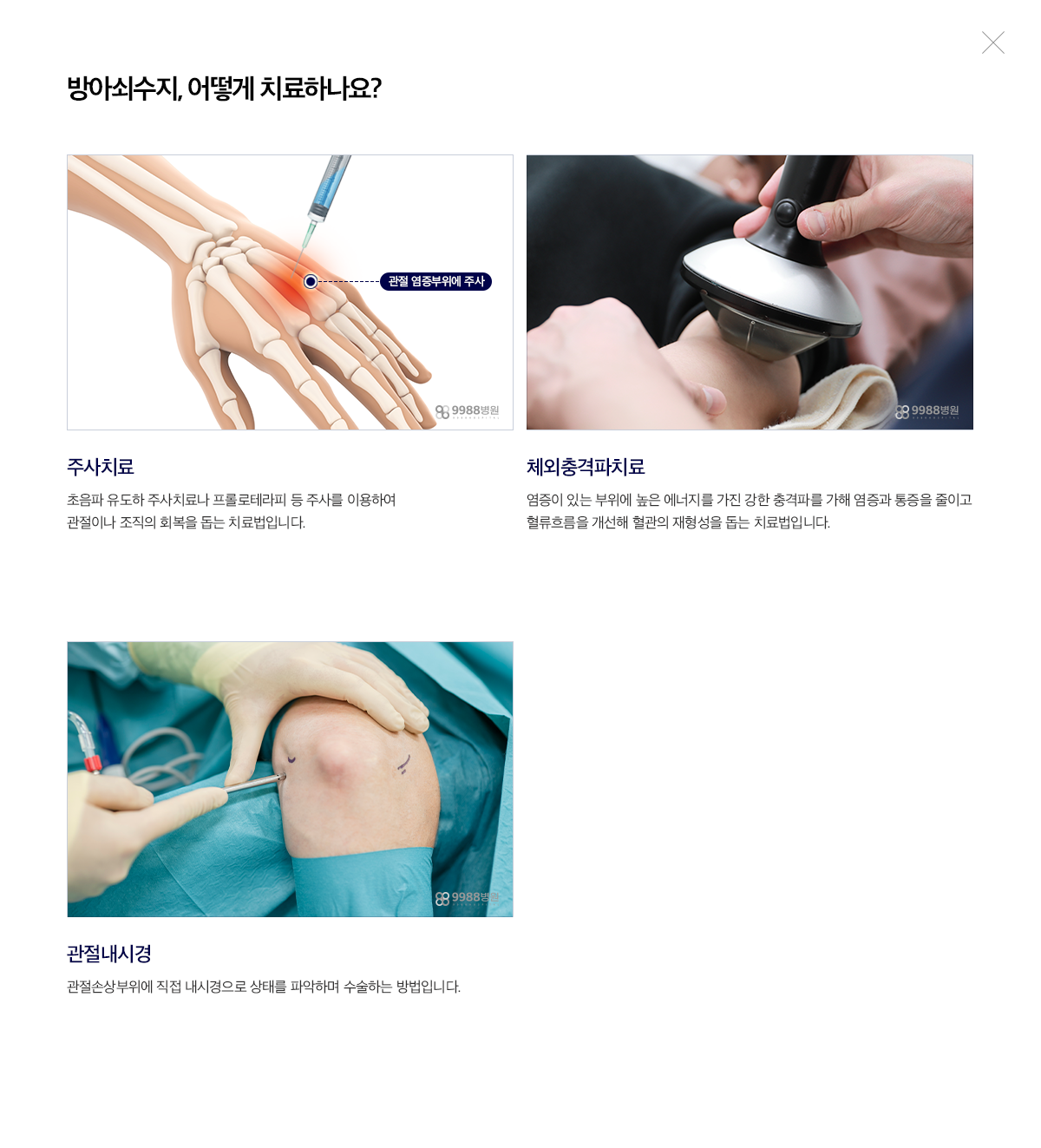 방아쇠수지