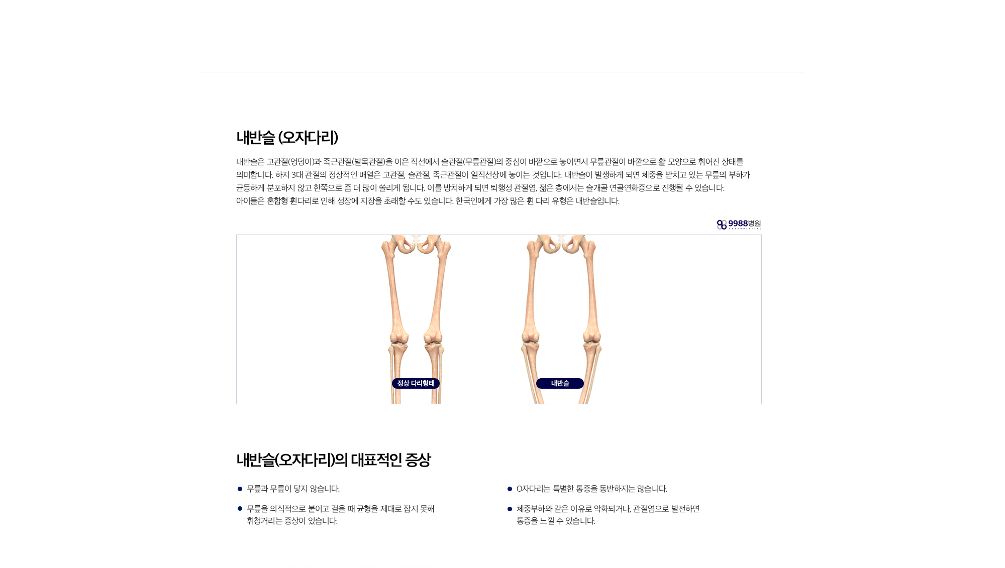 내반슬 (오자다리)