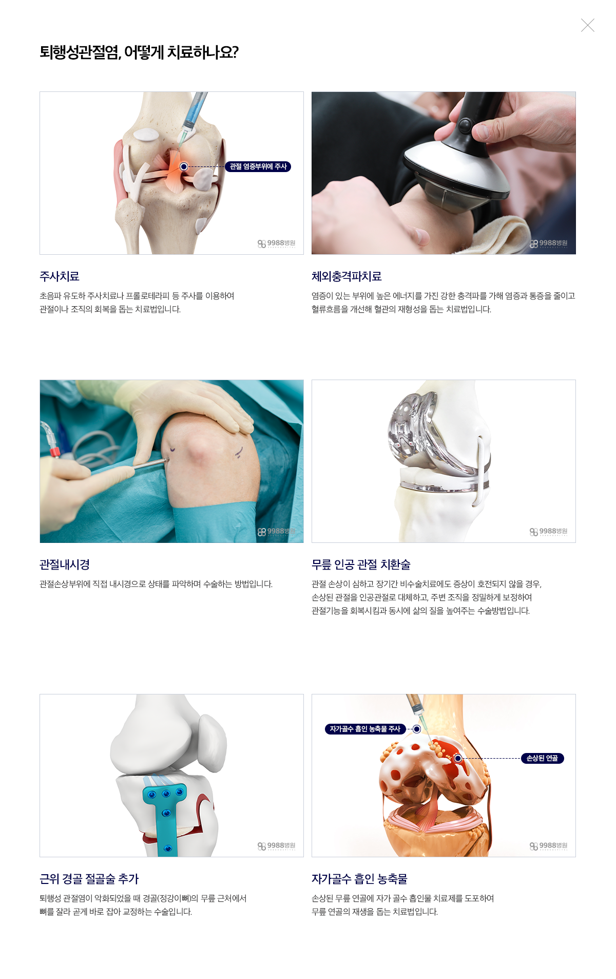 퇴행성 관절염
