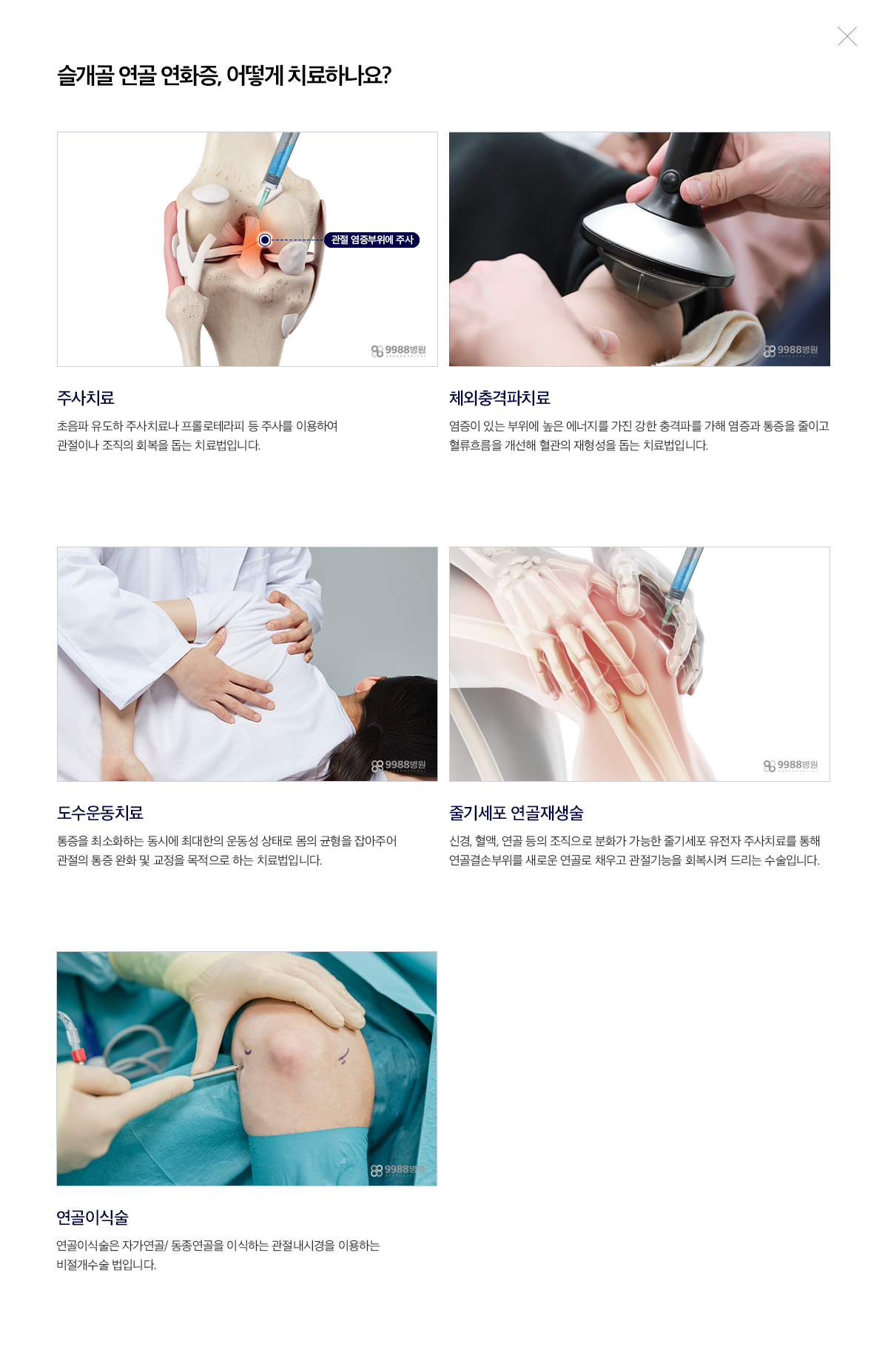 슬개골 연골 연화증