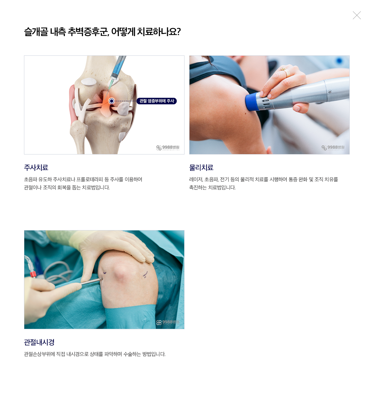 슬개골 내측 추벽증후군