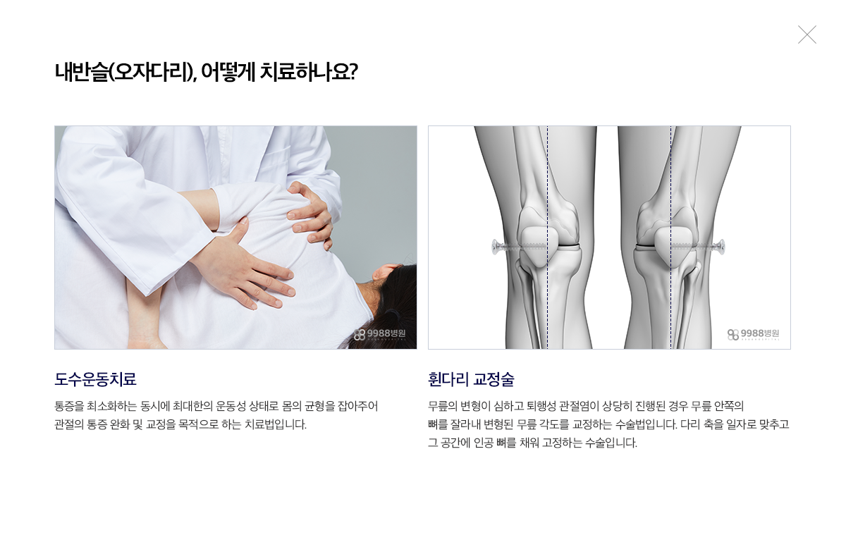 내반슬 (오자다리)