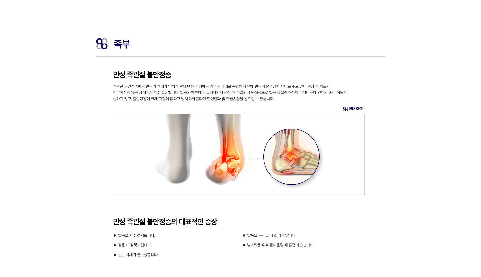 만성 족관절 불안정증