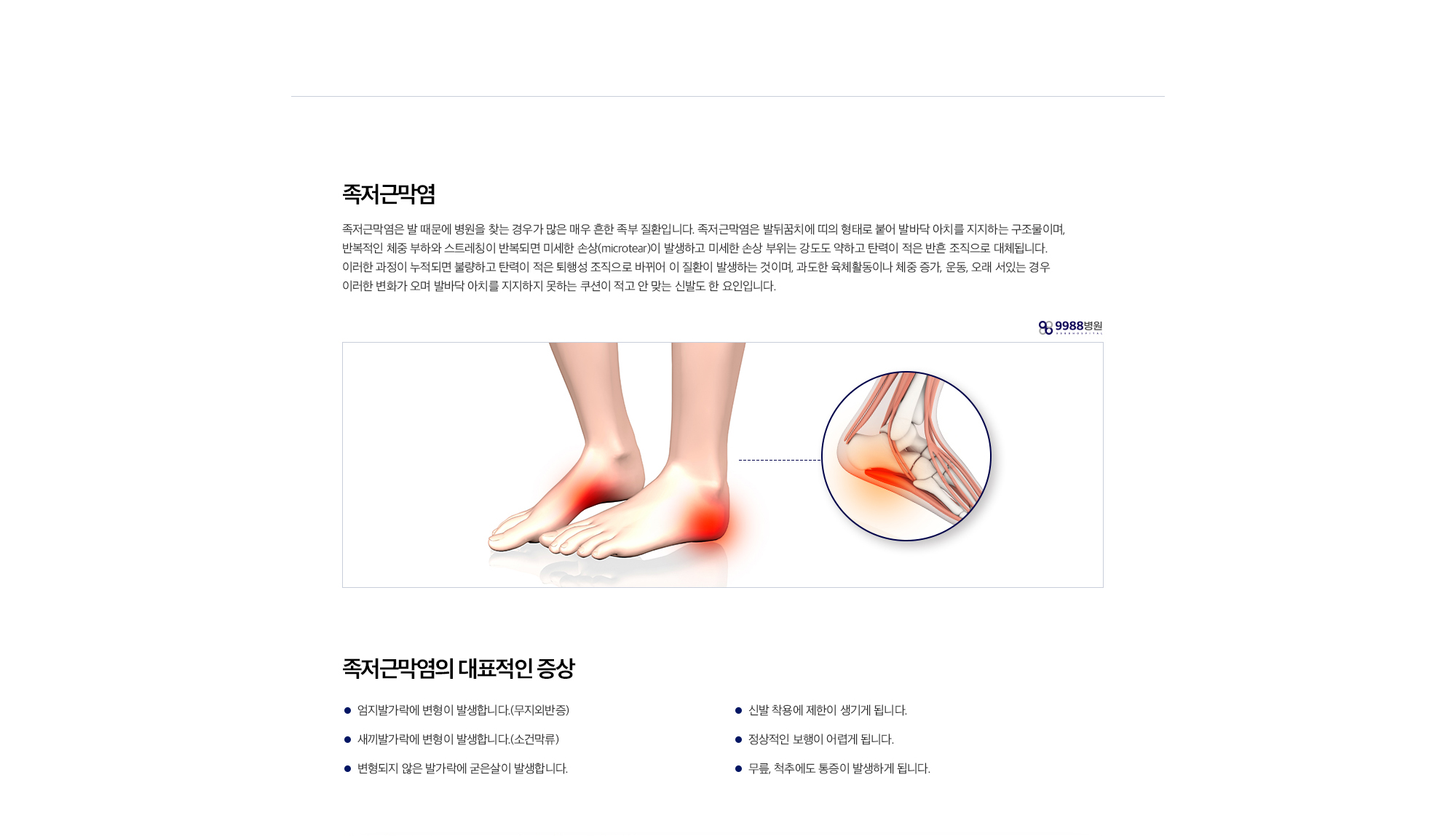 족저근막염