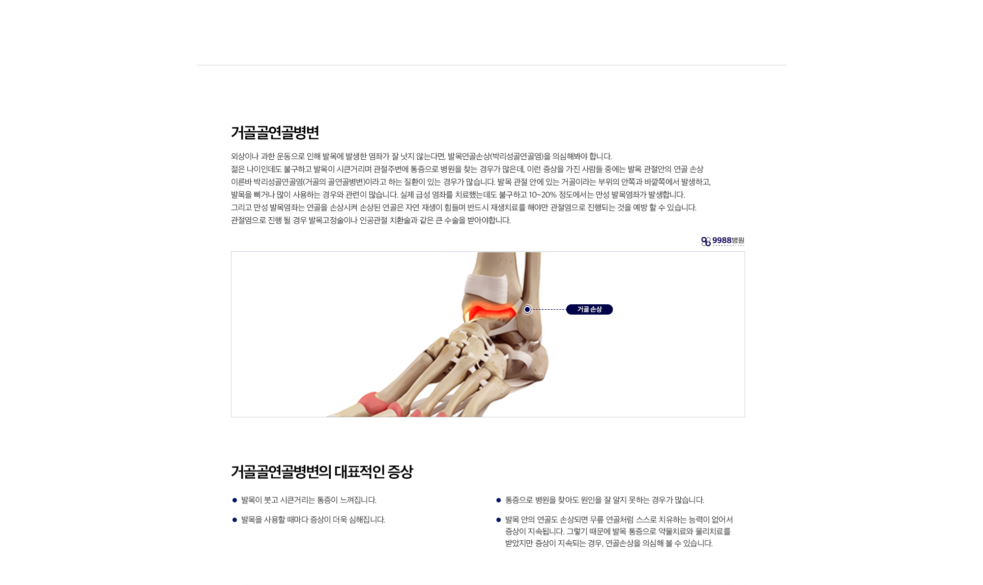 거골골연골병변