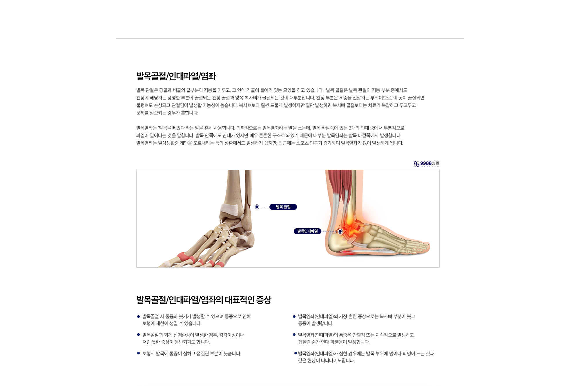 발목골절/인대파열/염좌