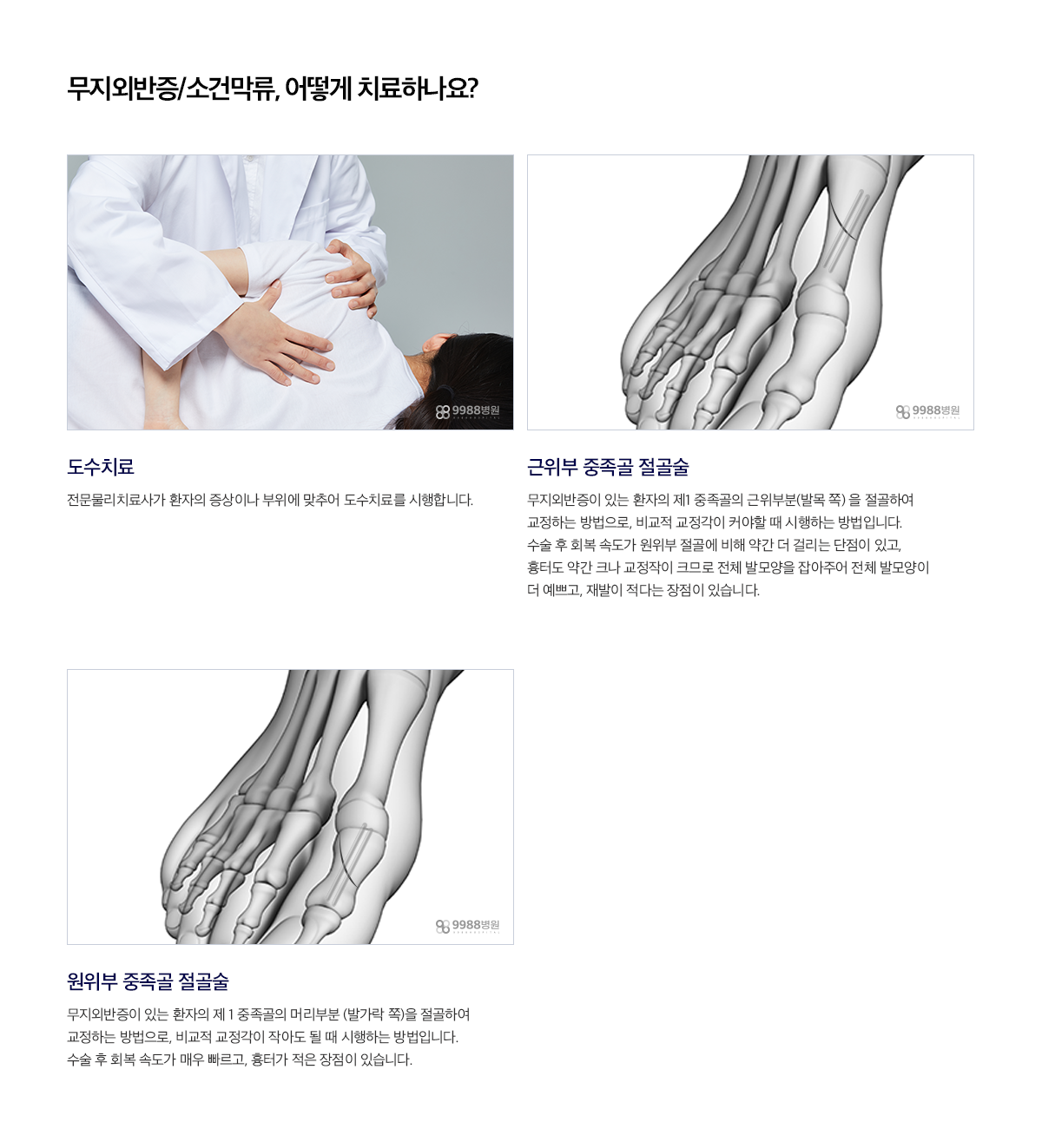 무지외반증/소건막류